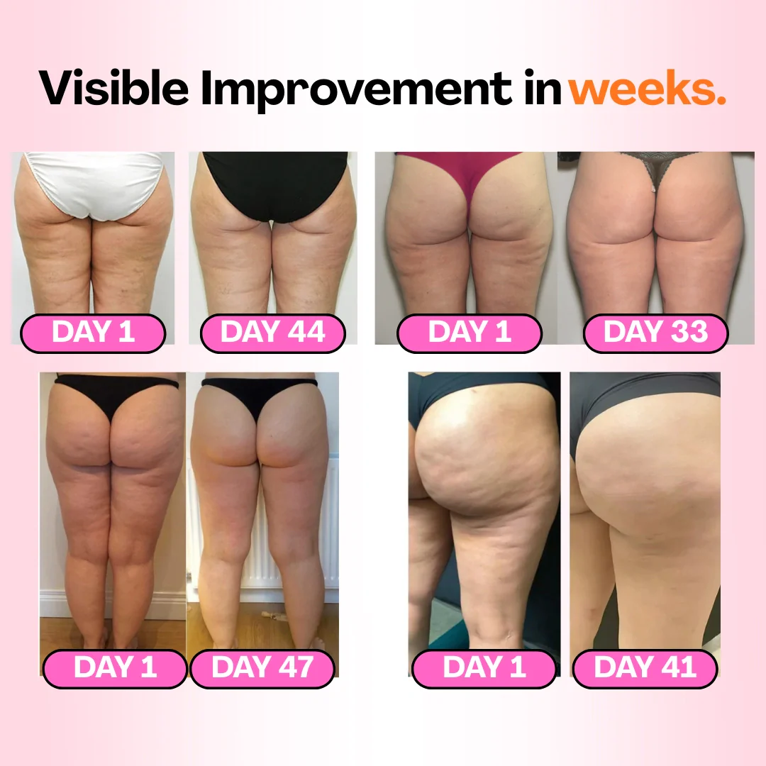 Anti-cellulite Tights -  Redefine your silhouette effortlessly (3-Pack) - Image 3