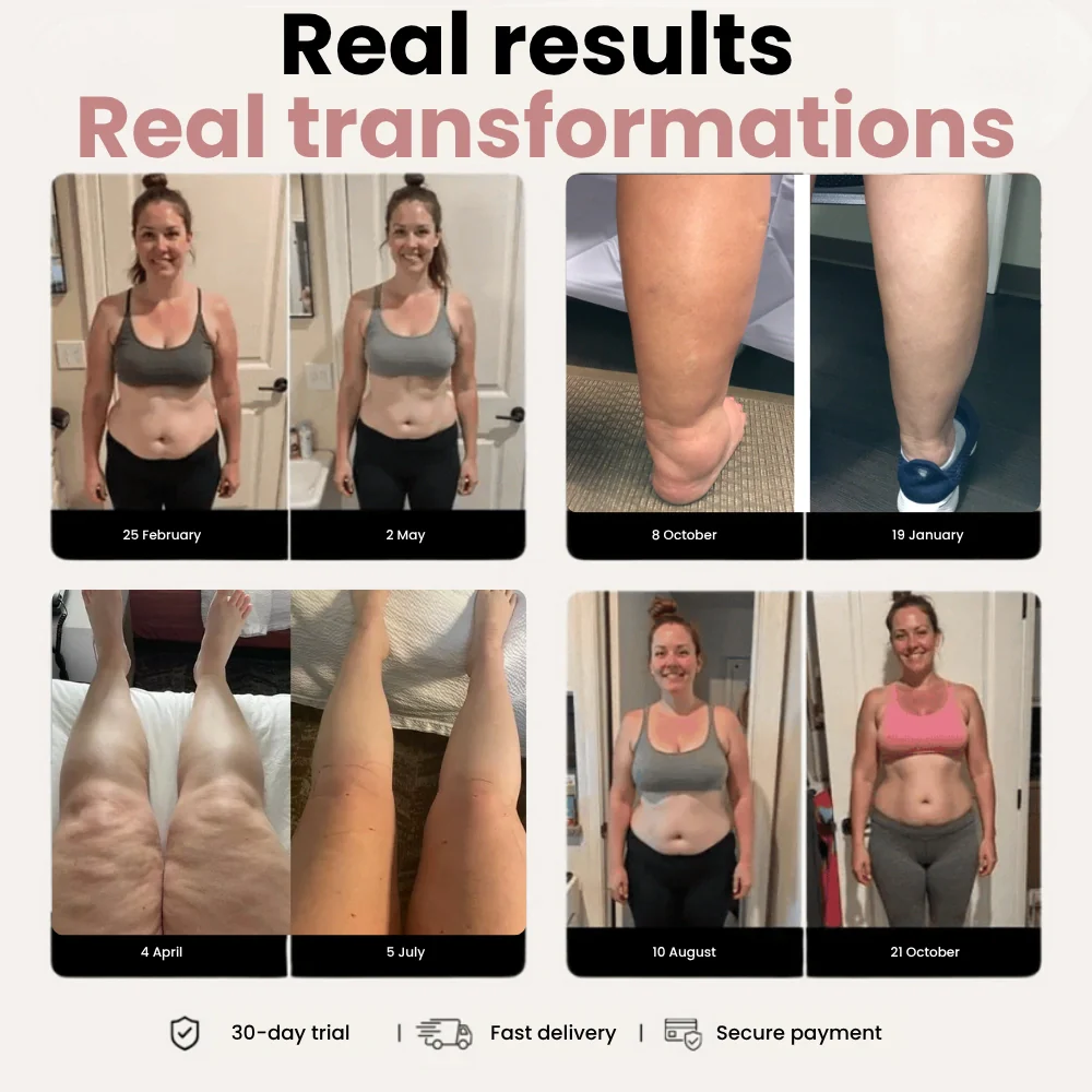 Cellumove 3D Legging – Designed to reduce post-partum swelling and restore comfort naturally - Image 5