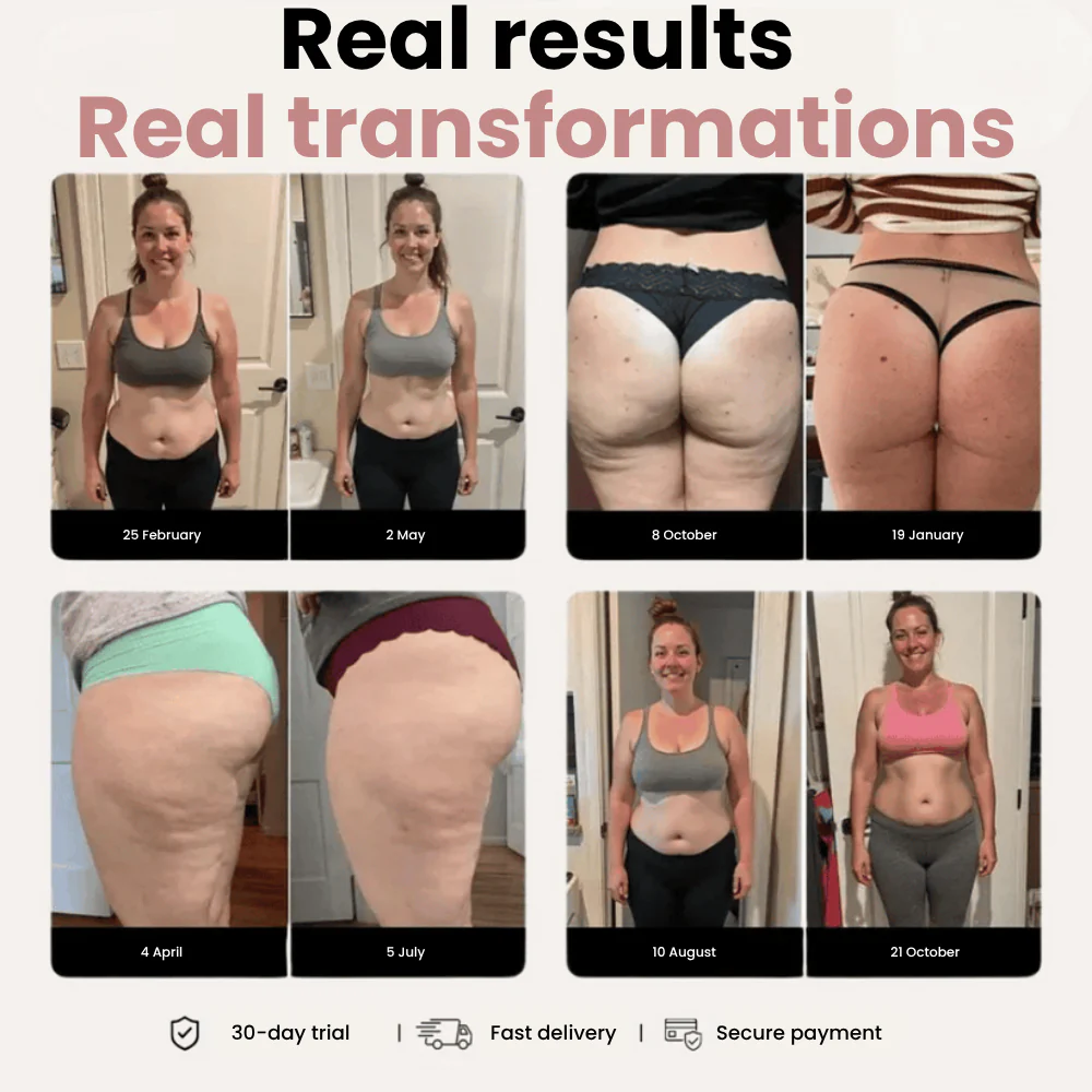 Cellumove 3D Legging – Say goodbye to lipoedema pain and swelling naturally - Image 4