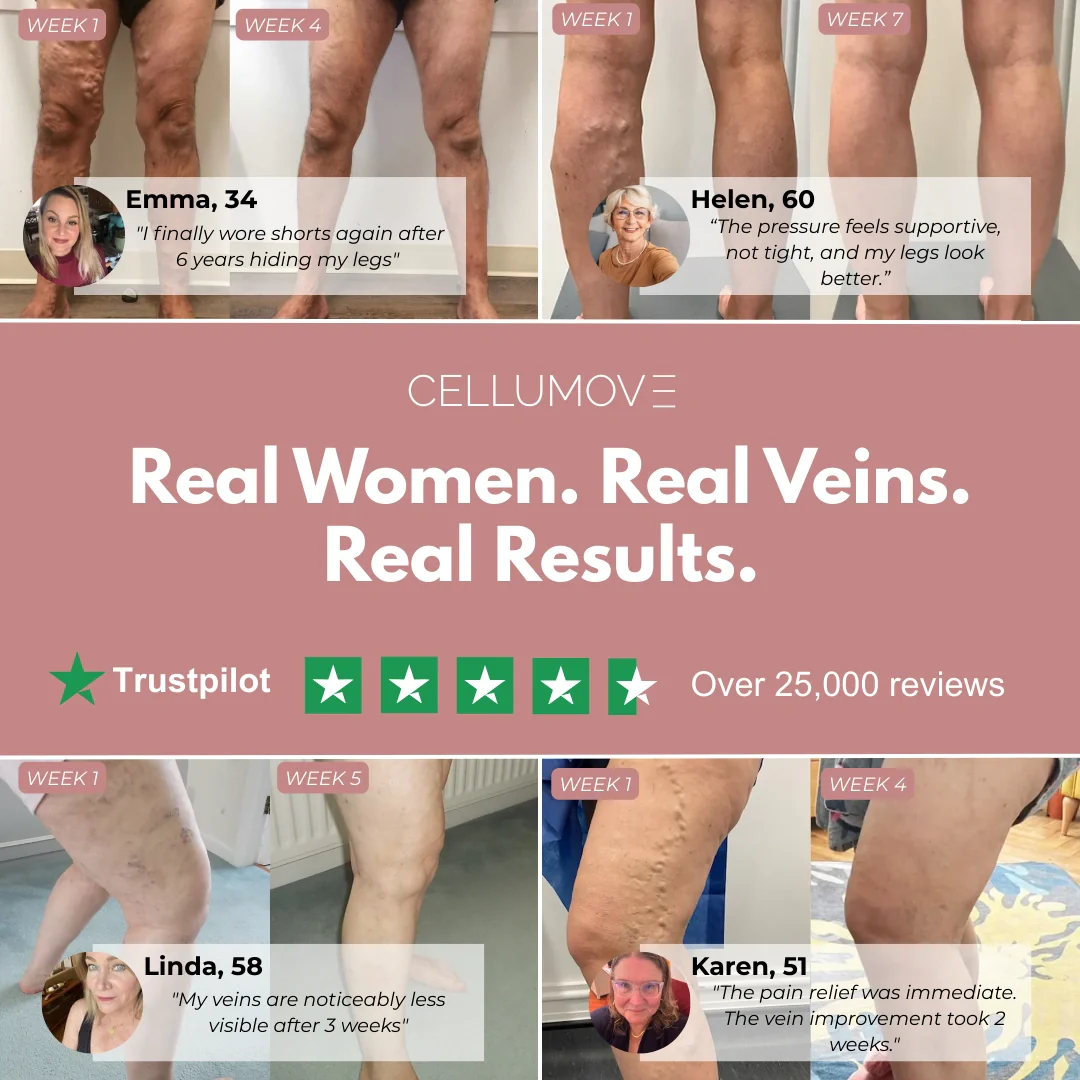 Visible Vein Relief in Just 14 Days with Cellumove 3D Compression Leggings - Image 7