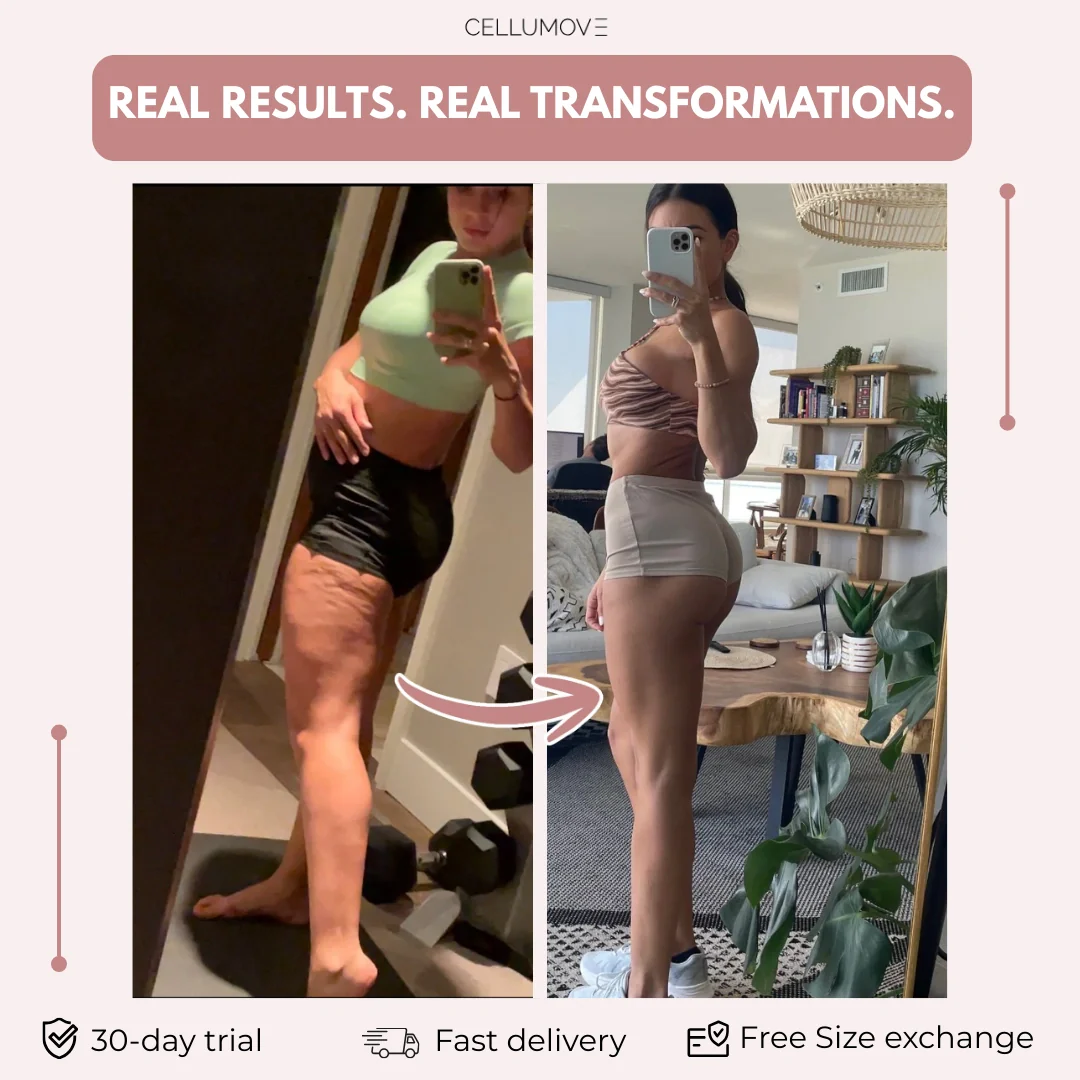 The anti-cellulite legging for women who've tried everything — visible results in 14 days - Image 3