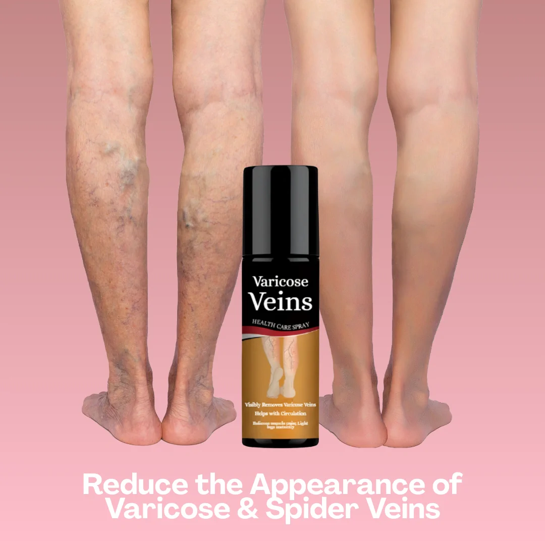 Varicose Vein Spray Leg Pain Gone, Confidence On - Image 4